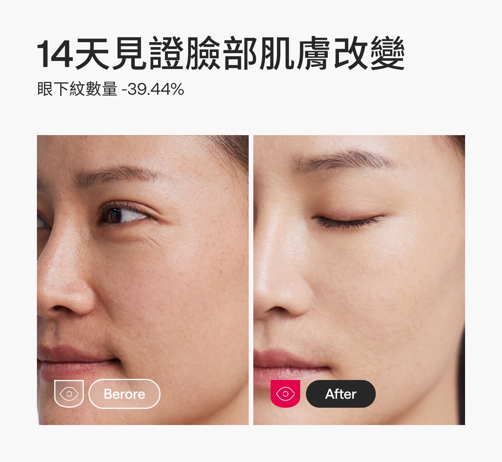 Ulike X 小象 超光炮美容儀-限時團購活動