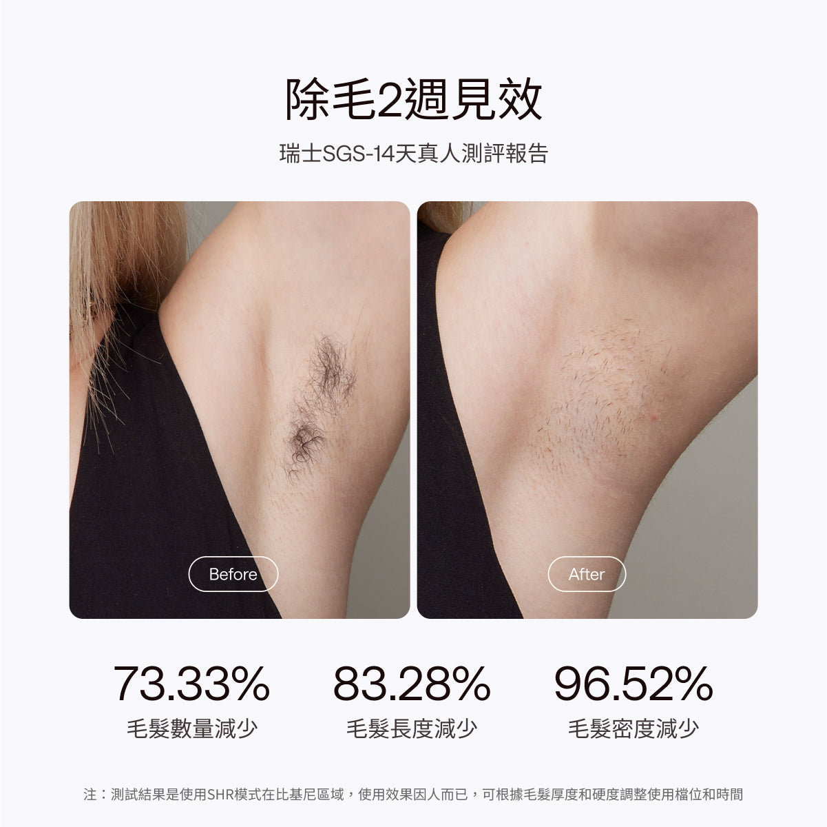 Ulike Air10家用除毛儀-限時團購
