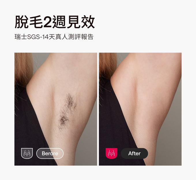 Ulike Air10家用除毛儀